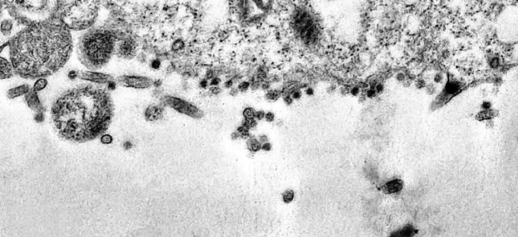 Zientzialariek harrapatu dute koronavirusak zelula osasuntsu bat kutsatu duen unea