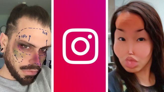 Instagram debekatutako kirurgia plastikoko iragazkia